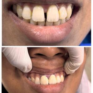 Who are the best dentists in Kolkata who are not too expensive? Who are the best dentists in Kolkata who are not too expensive?
