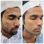 What are the top three private hospitals/clinics in Siliguri for skin treatment or dermatology? What are the top three private hospitals/clinics in Siliguri for skin treatment or dermatology?